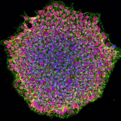Induced pluripotent stem cells